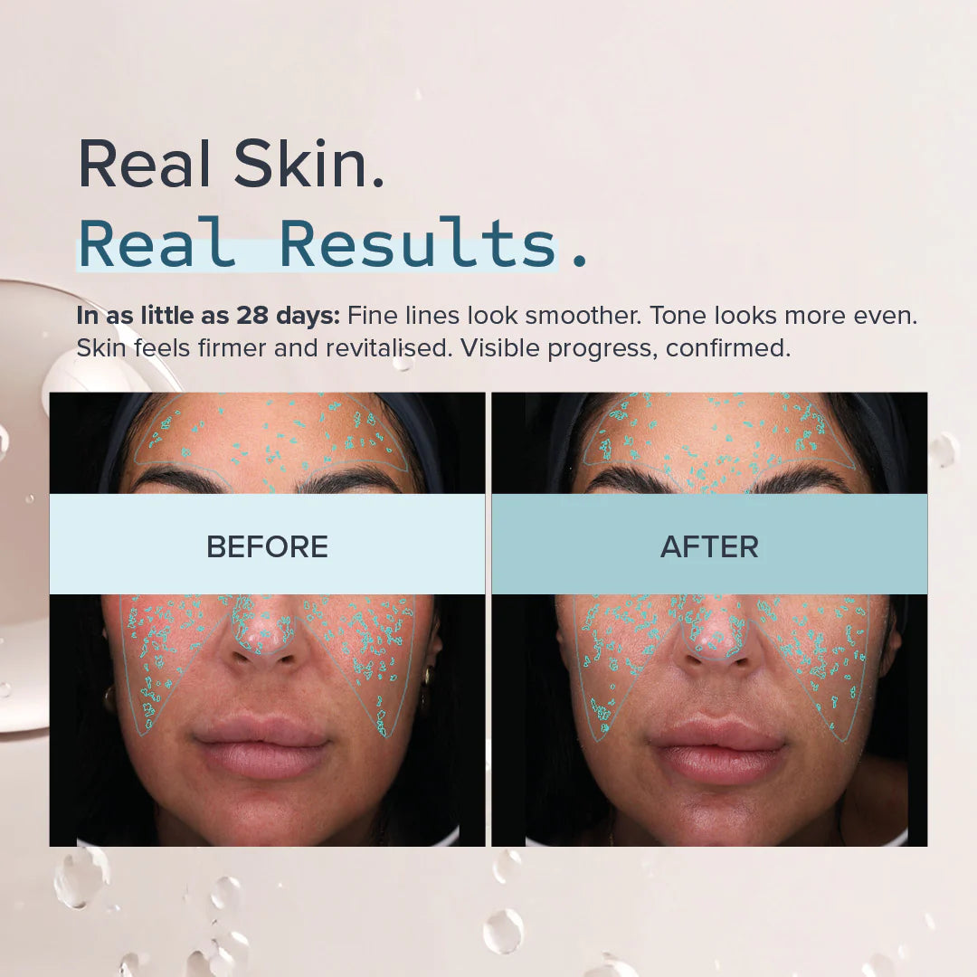 AlumierMD IntelliRET™ 0.3+ retinolio serumas, 30ml