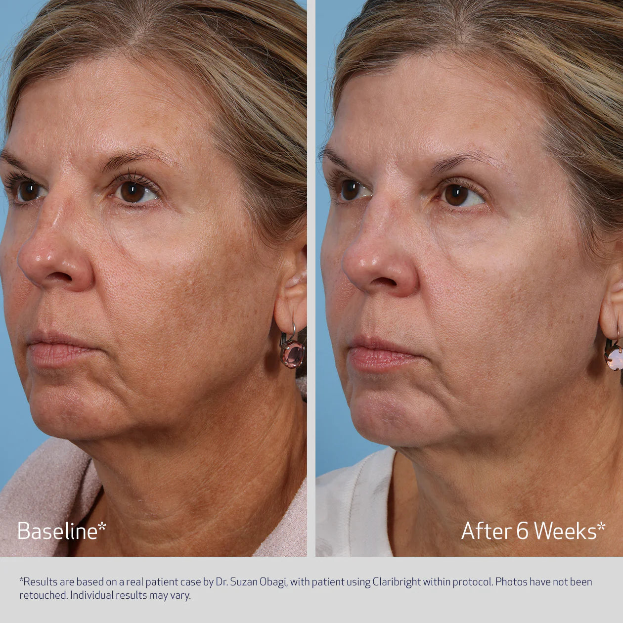 SUZANOBAGIMD® Claribright švytėjimo suteikiantis skaistinantis serumas, 50g